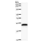 Monoclonal Mouse anti-Human HEC1 / NDC80 Antibody (clone 2497C3a, WB)