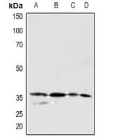 Polyclonal Rabbit anti-Human PDGF-CC Antibody (IHC, WB)