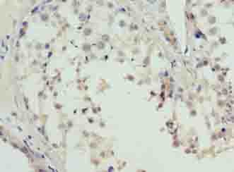 L3MBTL4 Antibody