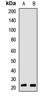 RBBP9 Antibody