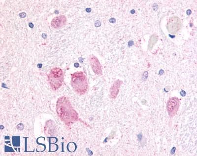 PathPlus™ Polyclonal Rabbit anti-Human GPR45 Antibody (Cytoplasmic Domain, IHC)