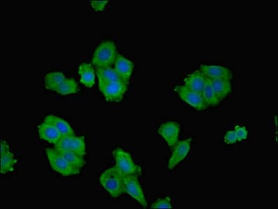 ROCK2 Antibody (aa1109-1388)