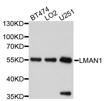 ERGIC-53 / LMAN1 Antibody