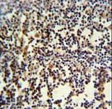 Polyclonal Rabbit anti-Human ANKRD49 Antibody (aa80-109, IHC, WB)