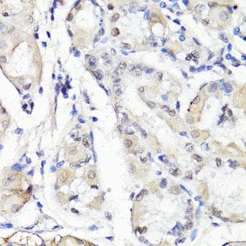 TBX20 Antibody