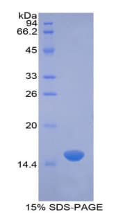 Rat VIP Protein (Recombinant His)