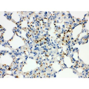 ITGA2B / CD41 Antibody (aa677-711)