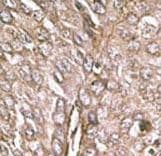 Polyclonal Rabbit anti-Human MAP1LC3B / LC3B Antibody (aa23-52, IHC, WB)