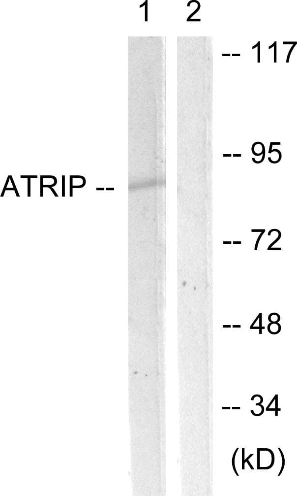 ATRIP Antibody (p68/72)