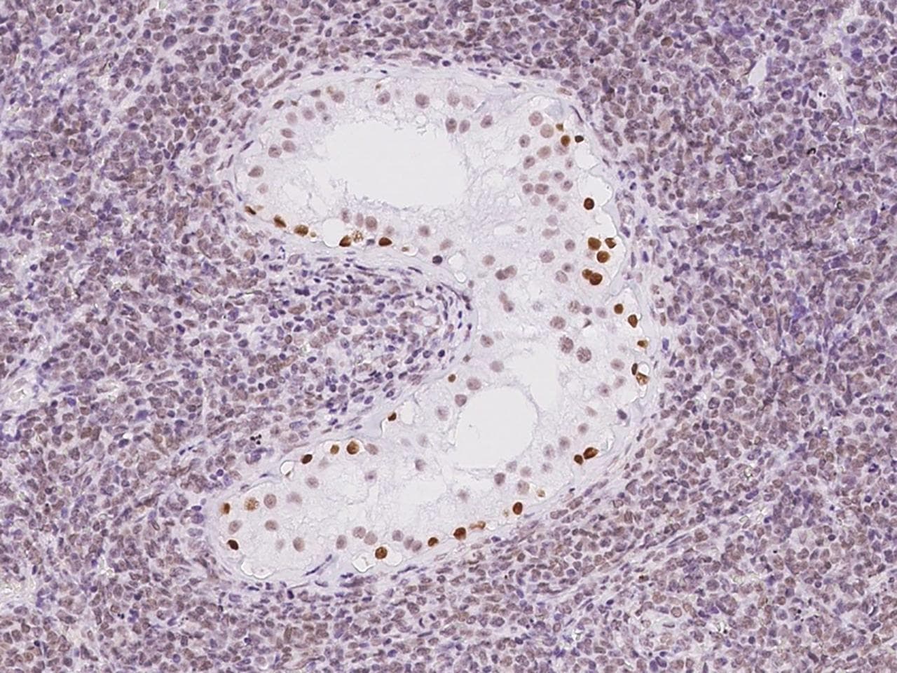 THYN1 / HSPC144 Antibody