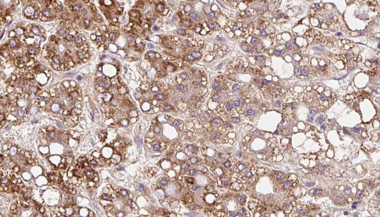 SLC6A20 Antibody