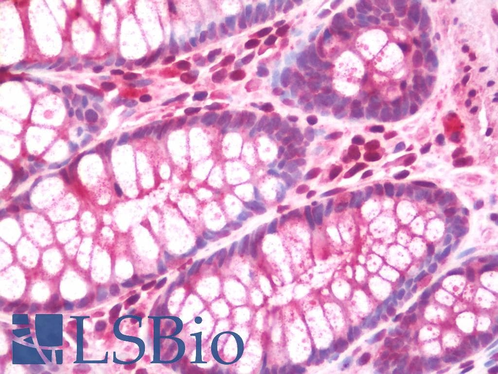 IHC-plus™ Polyclonal Rabbit anti-Human DIAPH2 Antibody (aa870-899, IHC, WB)