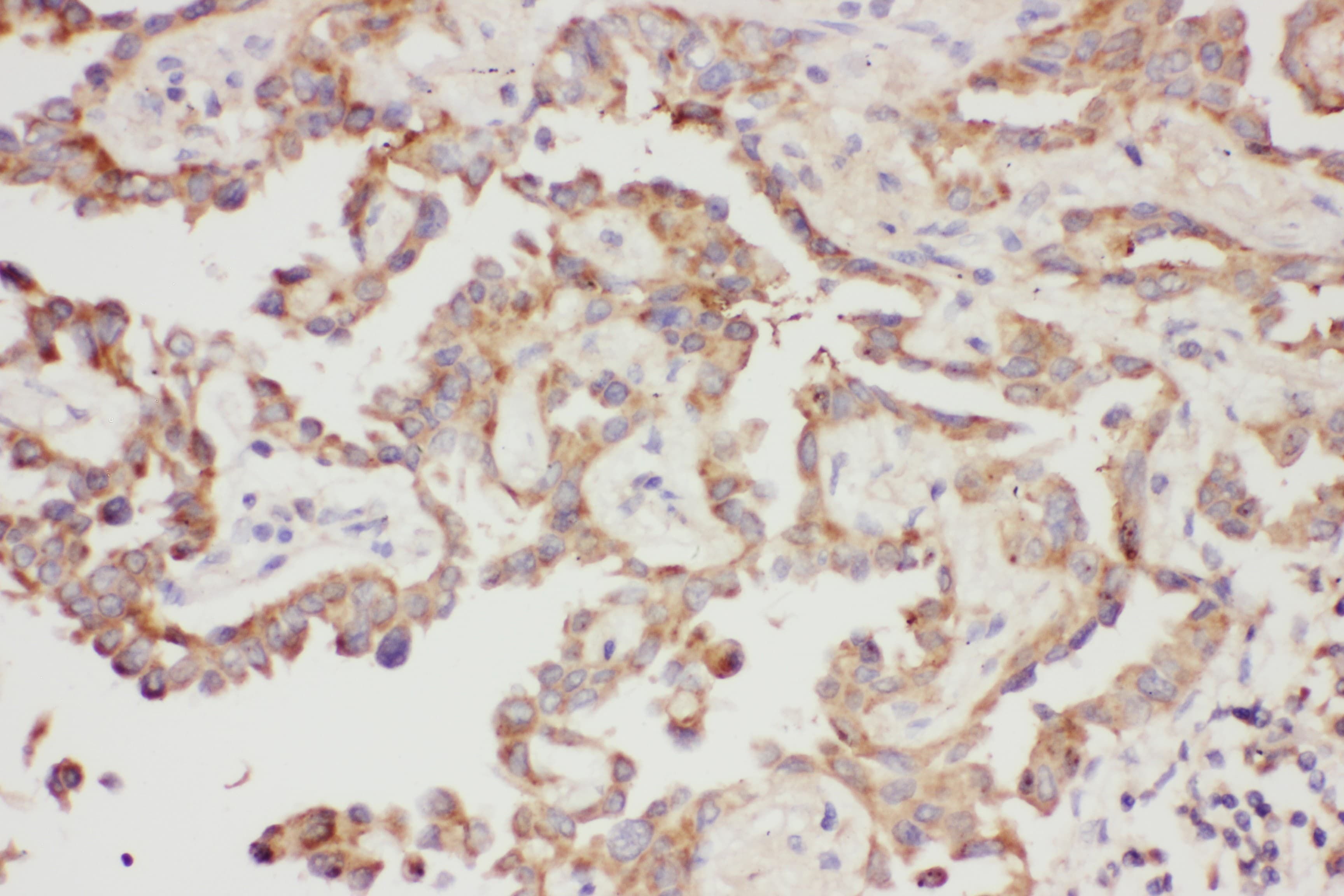 LGALS3 / Galectin 3 Antibody (aa139-250)