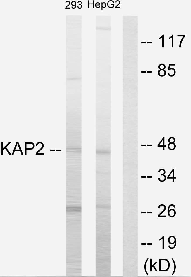 Polyclonal Rabbit anti-Human PRKAR2A Antibody (aa41-90, WB)