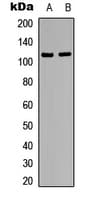 Polyclonal Rabbit anti-Human XRN2 Antibody (N-Terminus, IHC, WB)