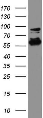 DDX56 Antibody (aa323-547, clone UMAB152)