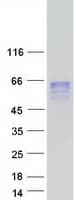 Human CHRDL2 Protein (Recombinant Myc-DDK (Flag))