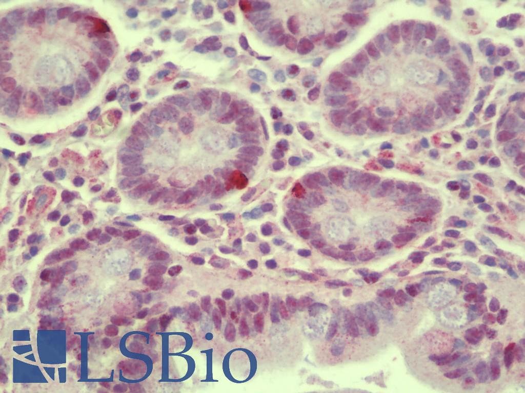 IHC-plus™ PRICKLE4 Antibody