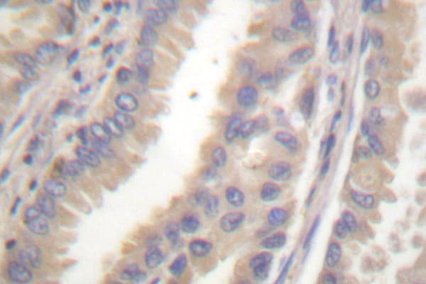 Polyclonal Rabbit anti-Human TIMP4 Antibody (Ser206, IHC, WB)