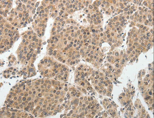 SOCS7 / SOCS-7 Antibody