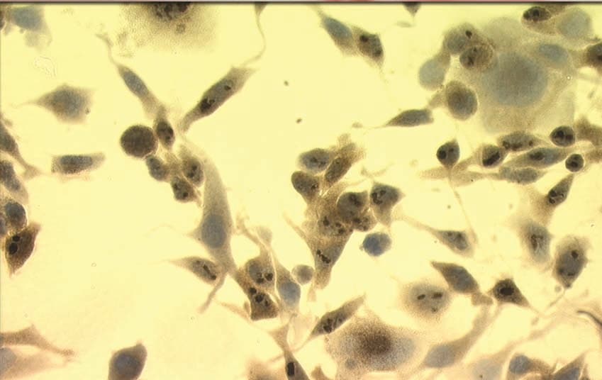 Monoclonal Mouse anti-Human HSP70 / Heat Shock Protein 70 Antibody (clone C92F3A-5, IHC, WB)