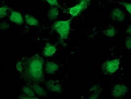 Monoclonal Mouse anti-Human PNMT Antibody (clone OTI2H6, IF, WB)