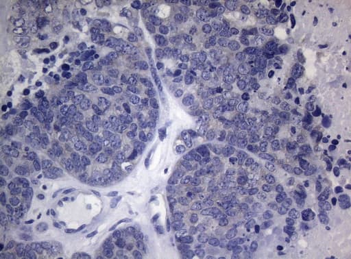 HOXD4 Antibody (clone OTI1E9)