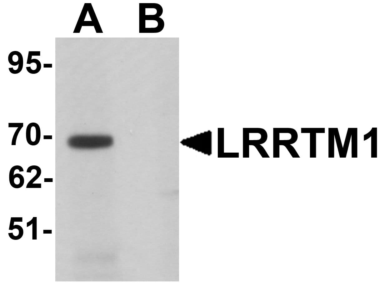 LRRTM1 Antibody