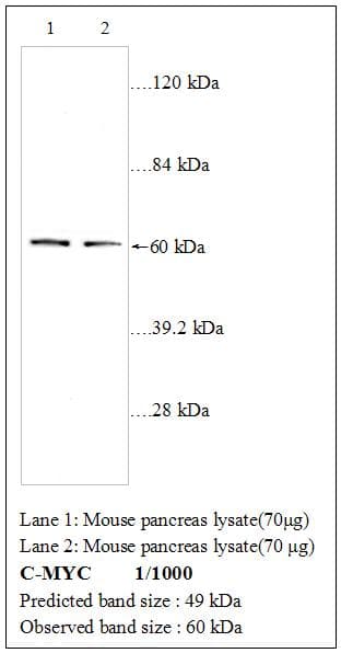 MYC / c-Myc Antibody