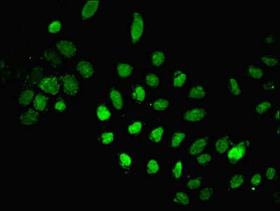 Polyclonal Rabbit anti-Human LIG1 / DNA Ligase 1 Antibody (WB)
