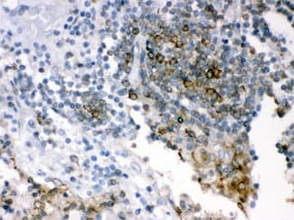 p66 / SHC Antibody