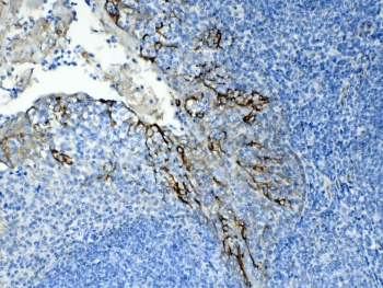 KRT8 / CK8 / Cytokeratin 8 Antibody