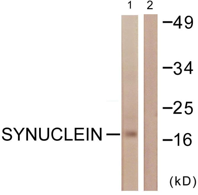 SNCA / Alpha-Synuclein Antibody (p129)