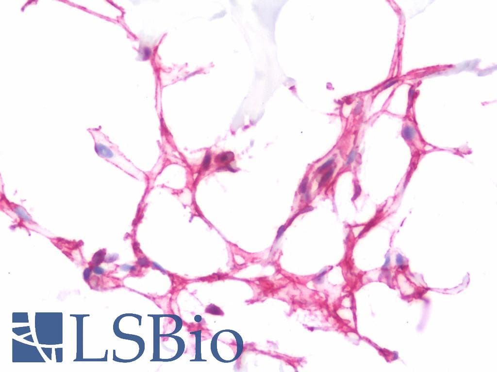 IHC-plus™ APOD / Apolipoprotein D Antibody (aa26-53)