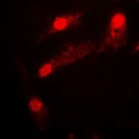 LIMK2 Antibody (Internal)