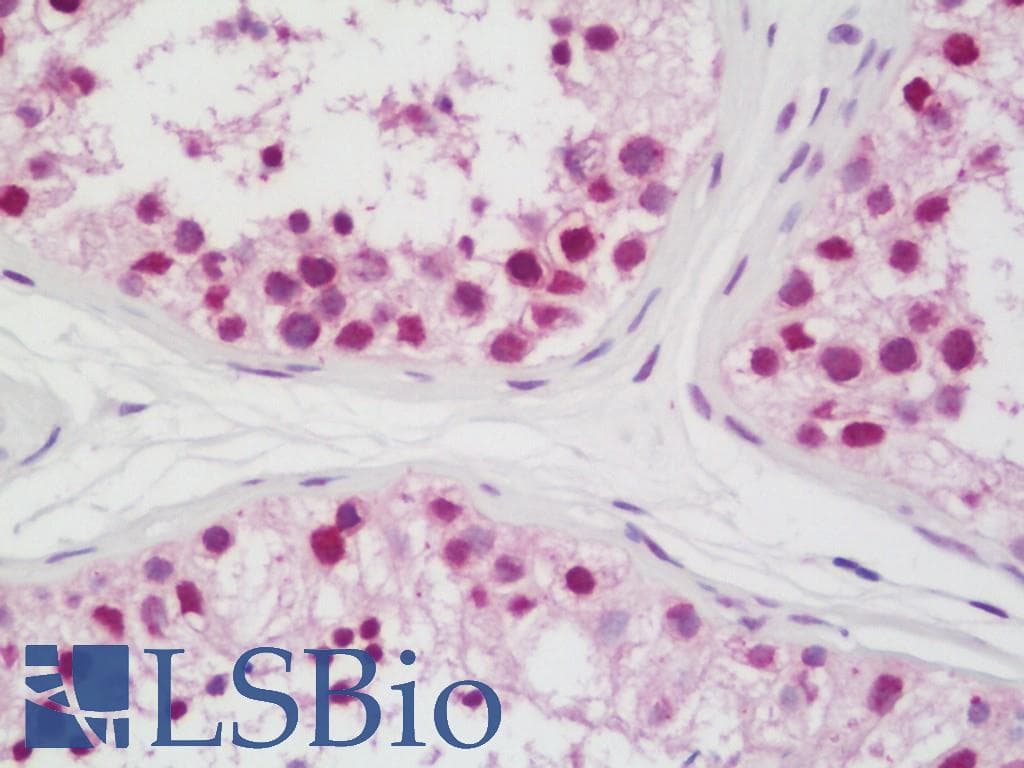 IHC-plus™ XPO1 / CRM1 Antibody (aa1025-C-term)