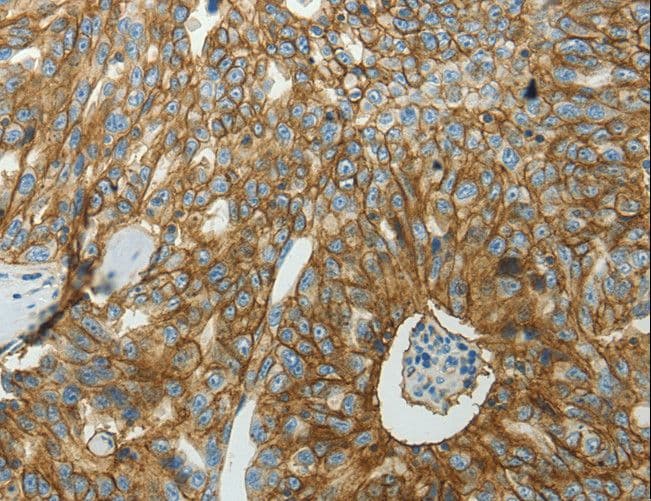 Polyclonal Rabbit anti-Human SLC16A1 / MCT1 Antibody (IHC)