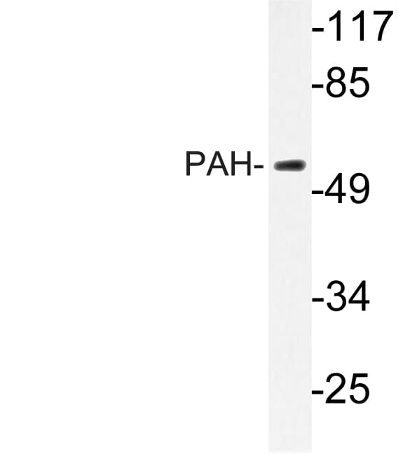 PH / PAH Antibody (Arg400)