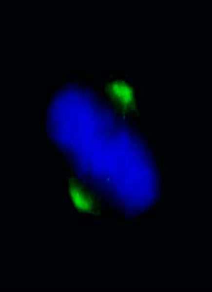 ASPM Antibody (aa3425-C-term)