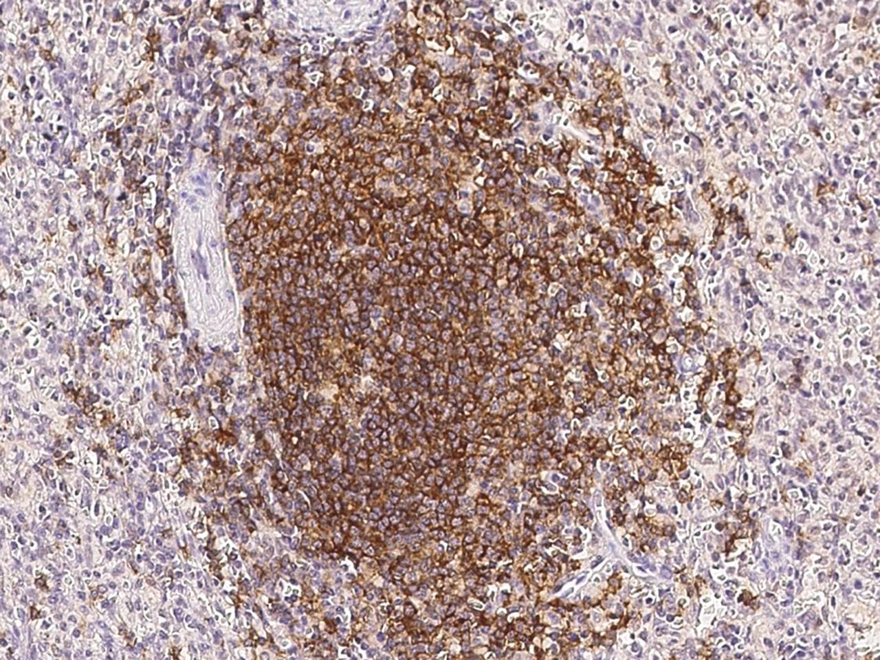 CD20 Antibody