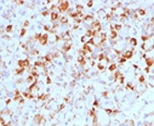LHB / Luteinizing Hormone Antibody (clone CCGD1)