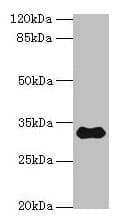 Polyclonal Rabbit anti-Human TMEM53 Antibody (IHC, WB)