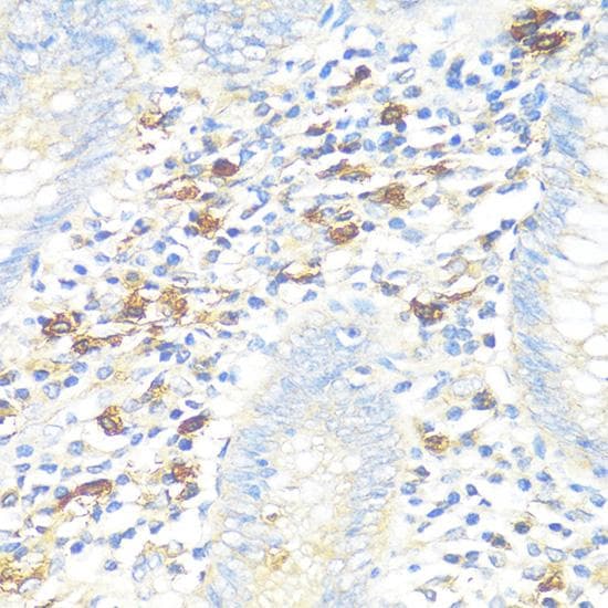TPSAB1 / Mast Cell Tryptase Antibody