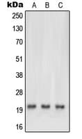 Ras (H, K, N) Antibody (N-Terminus)