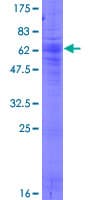 Human SLC17A3 Protein (Recombinant GST)