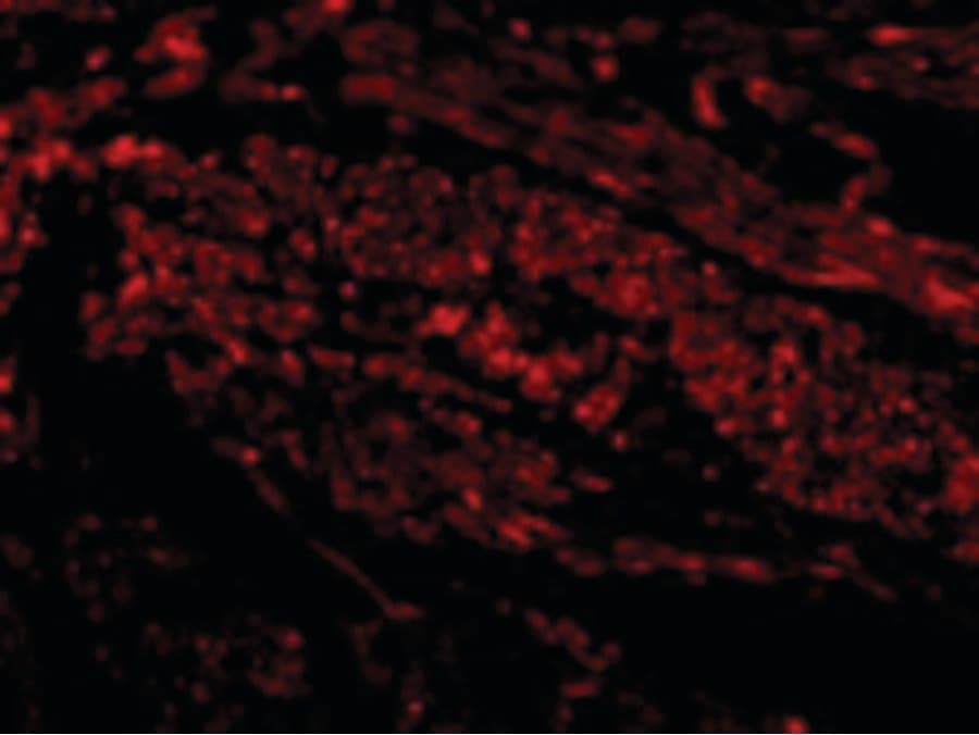 PathPlus™ HAVCR1 / KIM-1 Antibody