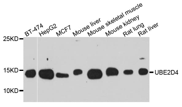 UBE2D4 Antibody