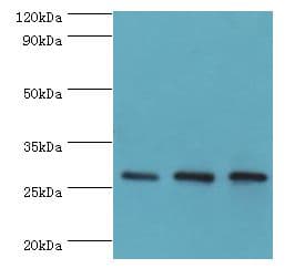Polyclonal Rabbit anti-Human ORC6 / ORC6L Antibody (aa1-252, IHC, WB)