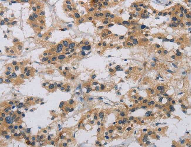 CASP9 / Caspase 9 Antibody