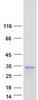 Human LY6K Protein (Recombinant Myc-DDK (Flag))